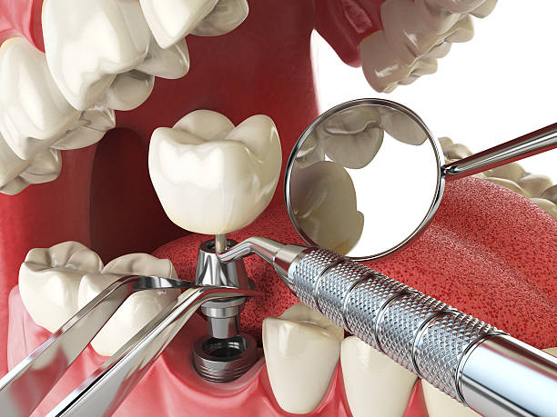 Best Pediatric Emergency Dentist in Ruckersville, VA